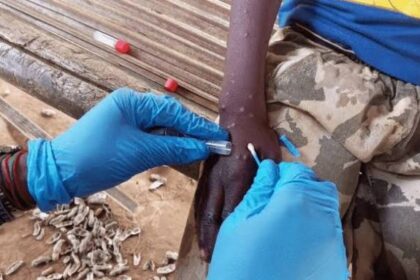 Mpox Case Reported in Trans Nzoia County