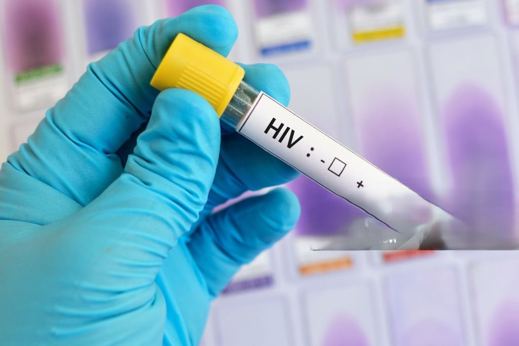 Kenya Steps Up the Fight Against HIV as Youth Infections Rise